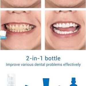 teeth whitening mousse 596499 NOMAN MALL